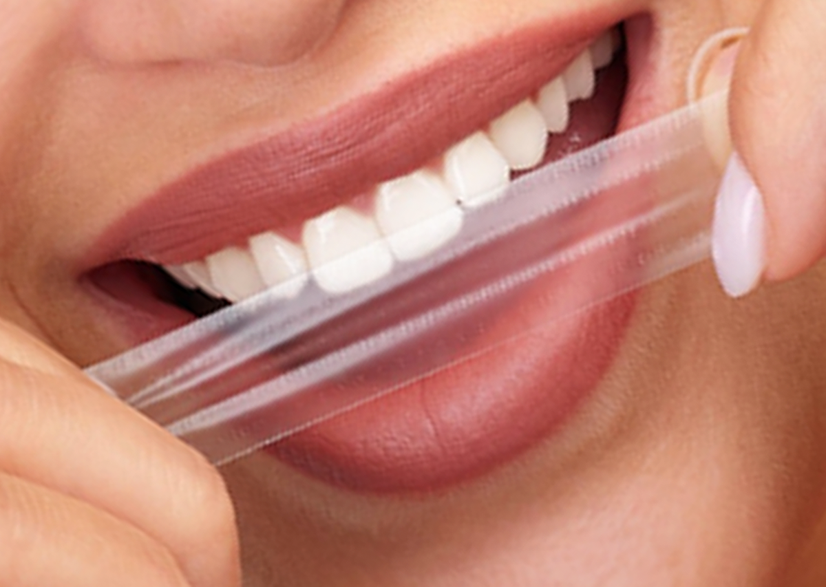 PAP+ Trakice Za Izbeljivanje Zuba Hello Smile Dev Osnovni proizvodi